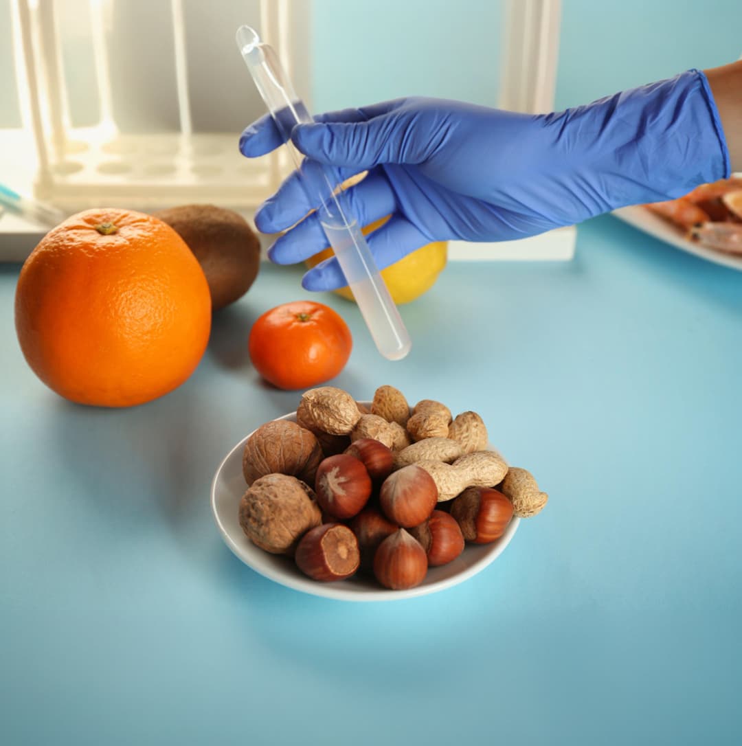 Food Allergy Test