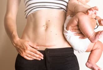 Cesarean Post Operative Care Before Childbirth