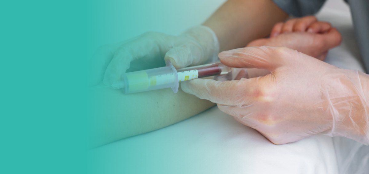 Glutathione IV Drip in Dubai