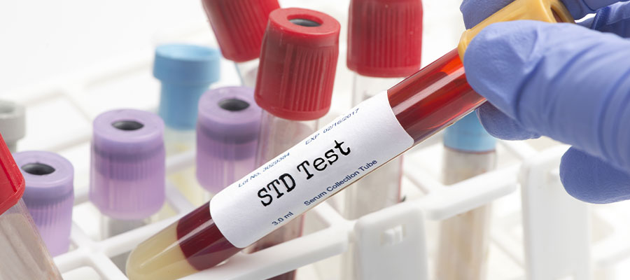 STD Test at Home