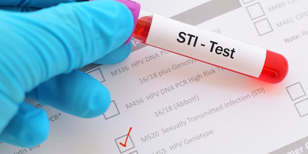 Std testing in Dubai