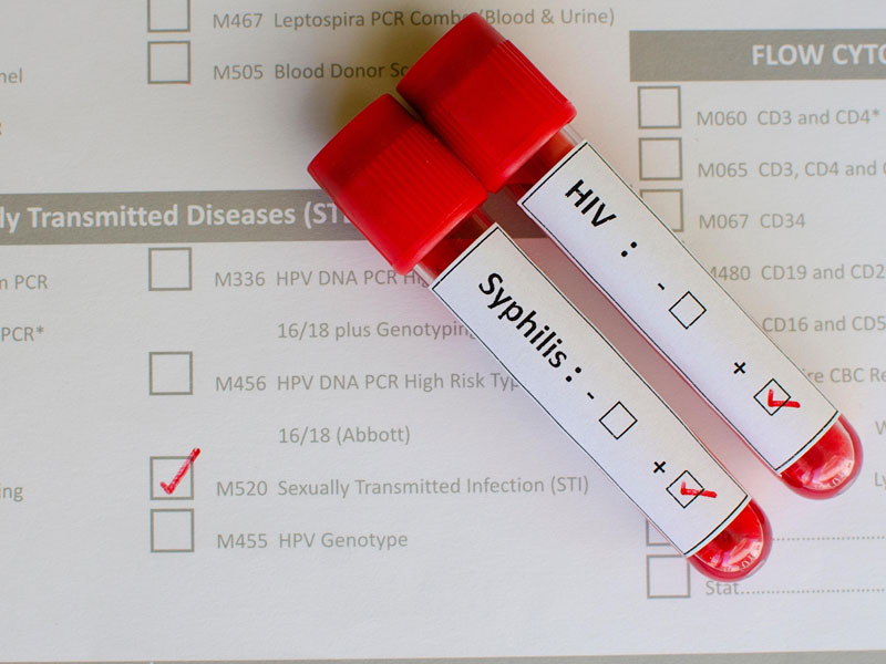 STD Clinic Dubai | STD Testing in Dubai