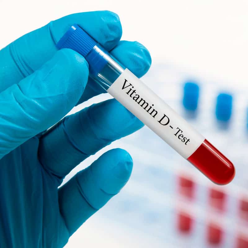 Vitamin D Test in Dubai: Signs, Testing & At-Home
